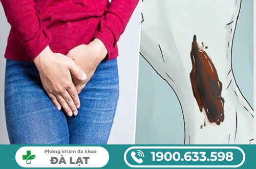 KHÍ HƯ MÀU NÂU ĐEN? PHƯƠNG PHÁP ĐIỀU TRỊ HIỆU QUẢ NHẤT!